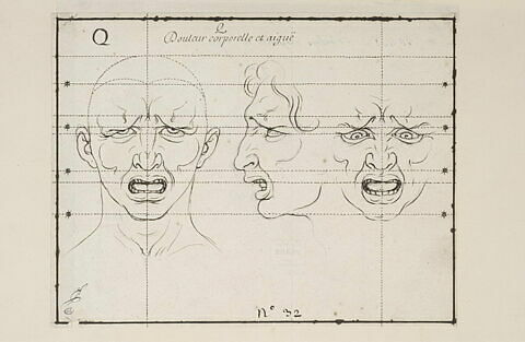 La Douleur corporelle et aiguë : deux têtes de face et une de profil